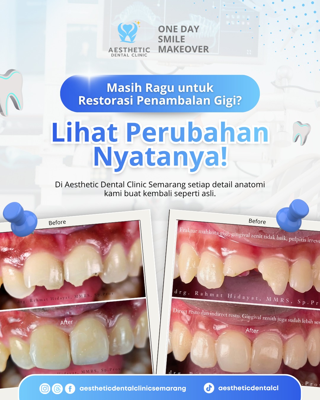 perubahan restorasi gigi
